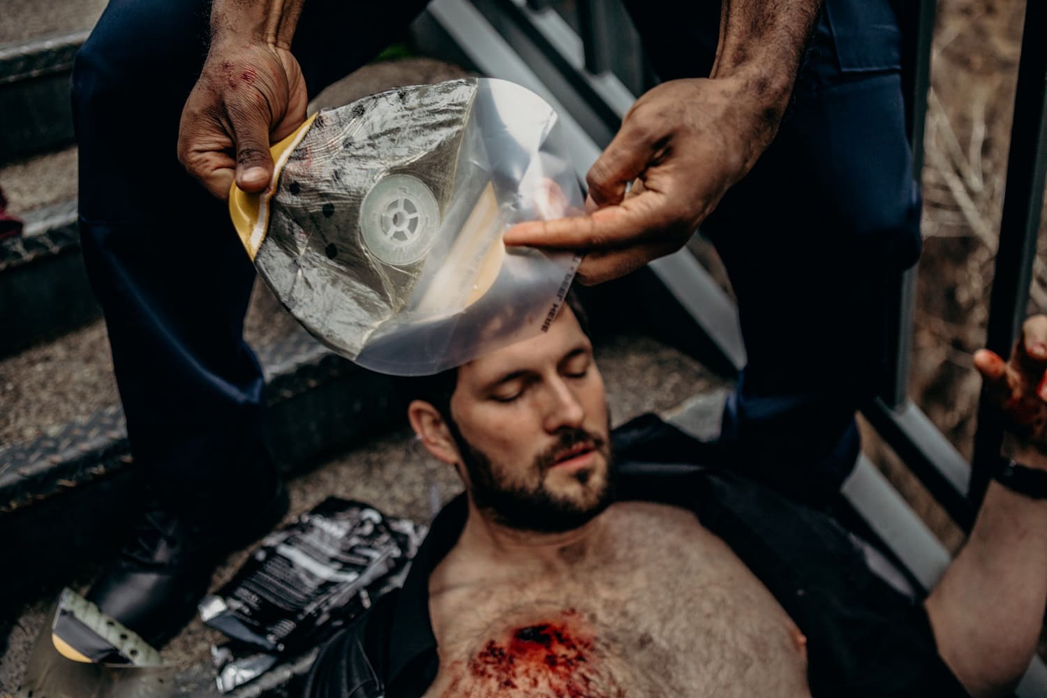 SAM MEDICAL Chest Seal - Non Valved